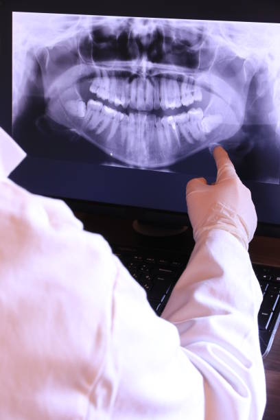 Best Broken or Chipped Tooth Repair in Romancoke, MD